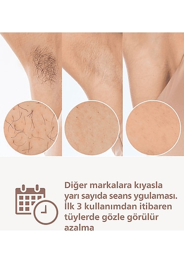 Phılıps Lumea Brı950/02 Ipl Epilasyon Cihazı