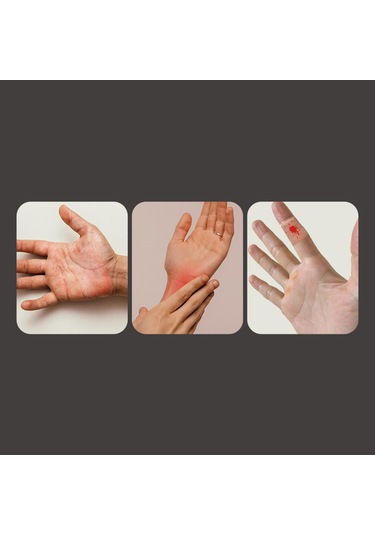 Homyl Gıda Doğrama Için Parmak Koruyucu Çok Fonksiyonlu Siyah