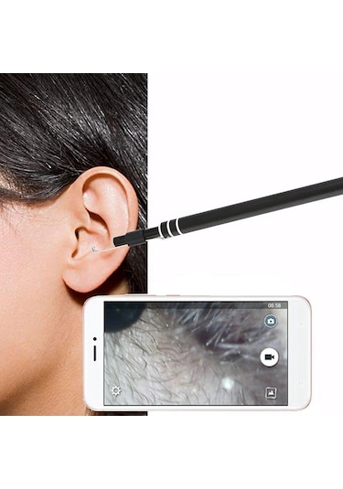 Kulak Muayene Endeskop Kamera 720P 3 in 1 Usb  Görsel Kulak Temiz