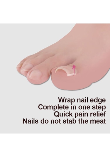 Moveevo Ayak Tırnağı Düzeltme Alet Seti 3 50 Batık Tırnak Düzeltme Pedi, 3 Parçalı Batık Tırnak Alet Seti