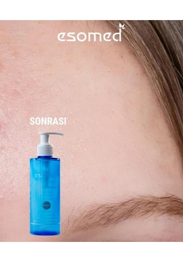 Esomed Yüz Temizleme Jeli 200 Ml