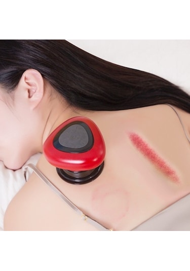 Lichen Elektrikli Hacamat Cihazı, Negatif Basınçlı Kazıma Çok Renkli