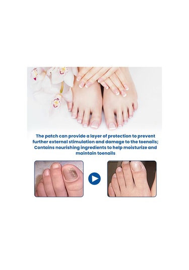 Aubyhe 32 Adet Tırnak Mantar İyileştirici Yama - 2.8x2.3cm, Glyserin & Çay Ağacı Yağı İçeren Tırnak Bakımı Ürünü