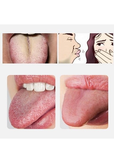 Çekici Ağız Temizleyici Kullanımı Kolay Paslanmaz Çelik Kırılması Zor