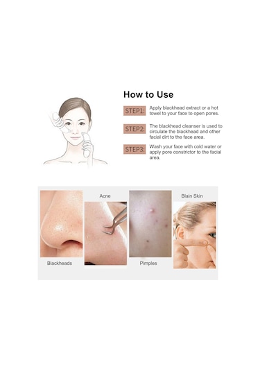 Hangfox Yüz Temizleme Aleti: Abs Malzeme Akne Karaburun Çıkarıcı, 500mah Pil, 3 Seviye Emme Gücü, 4 Farklı Uç, Gümüş Beyaz