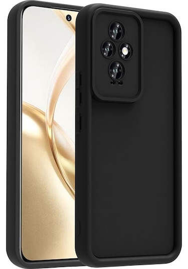 Zore Honor 200 Kılıf Kamera Korumalı Msra Ananas Kapak - Siyah Siyah