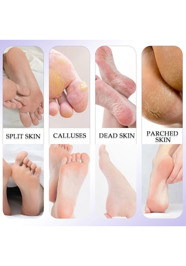 8 Adet/takım Profesyonel Ayak Bakımı Pedikür Nasır Ölü Cilt Sökücü Ayak Dosya Mısır Temizleme Aracı