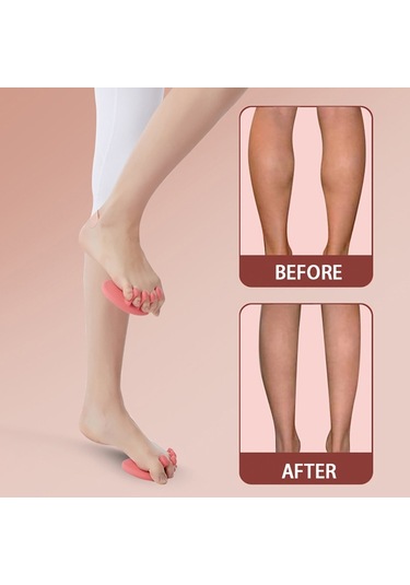 Sones Başparmak Valgus Düzeltme Kemer Eğitim Cihazı Mavi