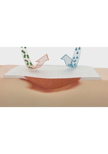 Coloplast 33435 Biatain Silikon Yapışkan Köpüklü Yara Örtüsü 10 x 10 CM 5 Adet