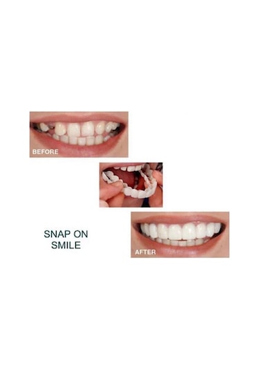 Suntek Silikon Üst/alt Takma Diş Kaplamaları Protez Sahte Üst