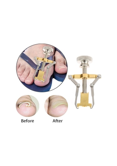 Batık Tırnak Çıkarıcı Aparat Çantalı Manikür Seti 12 Paçra