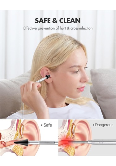 Anykit Dijital Otoskop, Ultra Net Görüşlü Kulak Kamerası - İpad/iphone/android