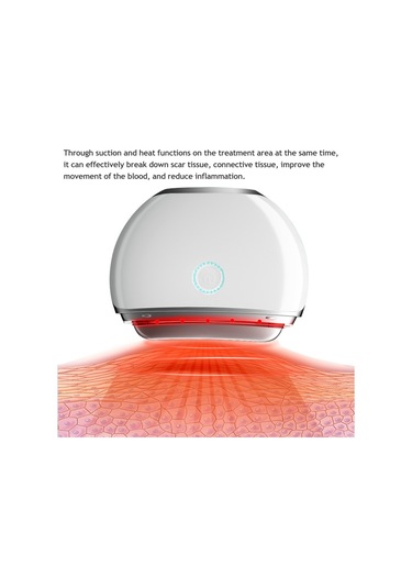 Shineyee Elektrikli Kupa Vücut Masajı Guasha Kazıma Makinesi Sırt Vücut İçin Ayarlanabilir Güçlü Emiş-517 Çok Renkli