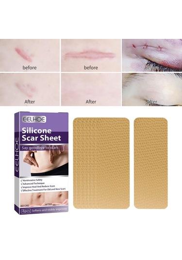 Dolıty Yanık İzleri Skar Yaması Çok Kullanımlı Yumuşak