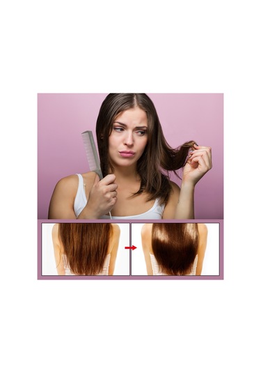 Xiyyadms Saç Bölme Ve Taşıma İçin İnce Uçlu, Paslanmaz Çelik Saplı Plastik Metal Saç Tarzı