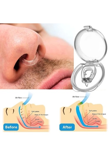 Mfa Taşınabilir Mini Manyetik Anti Horlama Burun Mandalı