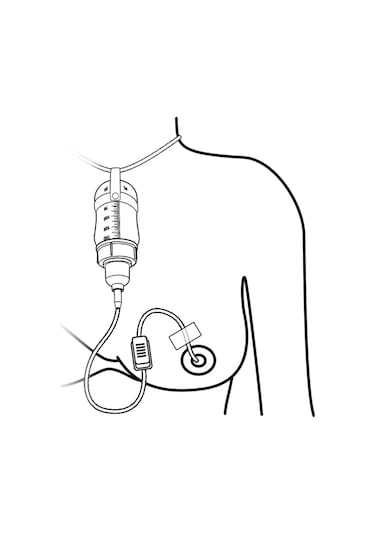 Eday Eds Emzirme Destek Sistemi Yedek Hortum (20 Adet)