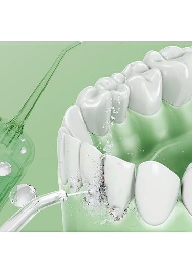 Lichen Elektrikli Su İpi, Taşınabilir Diş Temizleme Cihazı,