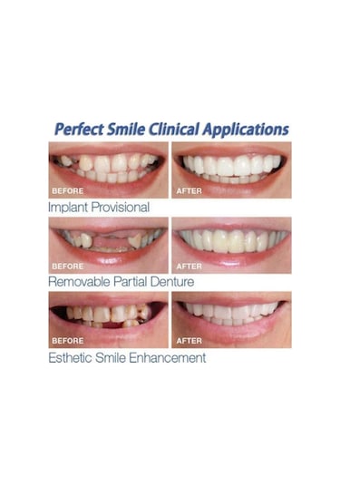 Suntek Silikon Üst/alt Takma Diş Kaplamaları Protez Sahte Üst