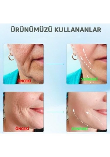 Yüz Ve Boyun Masaj Aleti Ems Cihazı Güzellik Cihazı 3 Programlı Yüz Masaj Aleti Sıkılaştırıcı Masaj Aleti Kırşıklık Giderici Masaj Aleti Isıtmalı Masaj Titreşimli Masaj Aleti Mg102q Çok Renkli