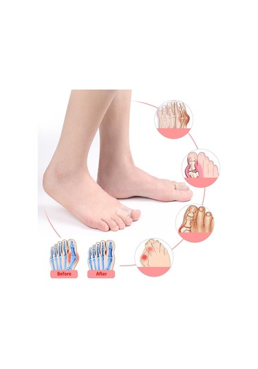 Homyl 2 Adet Burun Ayırıcı Halluks Valgus Için Parmak M-beden