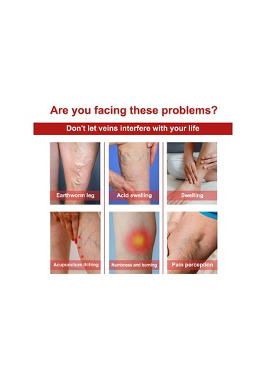 Vkemall Jaysuing Varis Rahatlatıcı Bant - Bacak Ağrısı Ve Şişlik İçin 12'li Paket