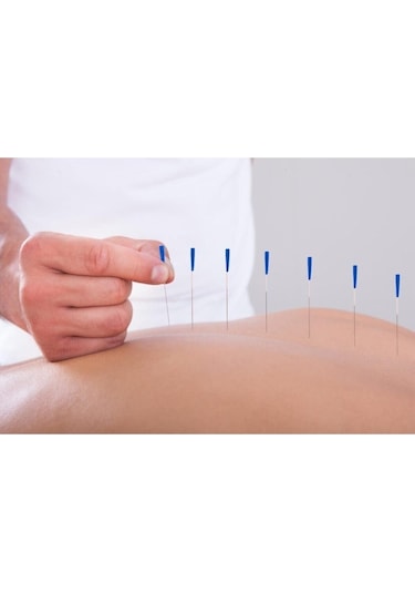 Medikaltec Akupunktur Iğnesikuru Iğne,acupuncture Needle 0.35 100mm