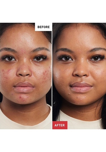 Erborian Ginseng Bb Crème Baby Skin Effect Nude - Bb Krem