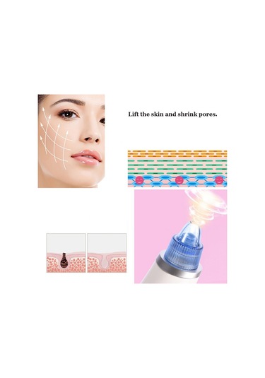 Sones 5w 1a Çok İşlevli Siyah Nokta Çıkarıcı Gözenek Temizleyici Dört Problu Pembe