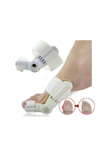 Ayak Başparmak Kemik Düzeltici Halluks Valgus Bunyon Gece Ateli