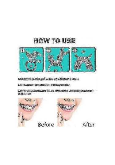 Elektrikli Diş Fırçası Yetişkinler - Ultrasonik U-şekilli Diş Fırçaları - 360 Ağız Temizleme - Kablosuz Şarj Ve Led Işık - Siyah Sertifikalı Whit Walkbee