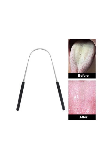 Dolıty Diller Kazıyıcı Taze Nefes Için Temizleyici Siyah