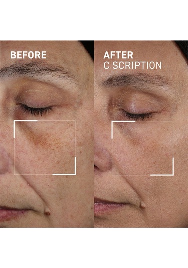 Dr. Brandt Bright This Way C Scrıptıon Serum 30 Ml