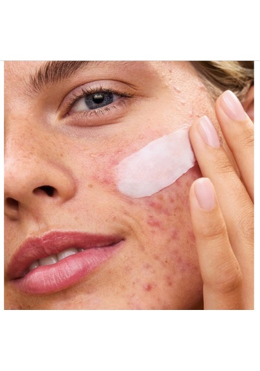 First Aid Beauty Ultra Repair Rescue Balm - Dimetikonlu Ultra Onarıcı Rahatlatıcı Balsam 64 Gr