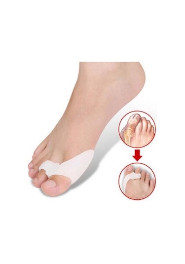 Silikon Makaralı Ayak Baş Parmak Kemik Koruyucu Bunyon