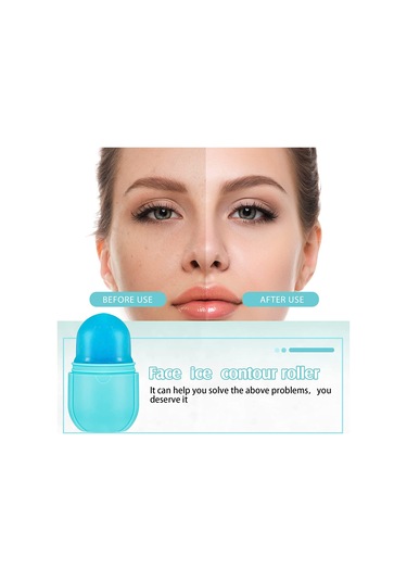 Samdoo Yüz Masajı İçin El Kullanımlı Silikon Buz Topu Masajcı Pembe, Gül Kırmızısı Hediye Kutulu Çok Renkli