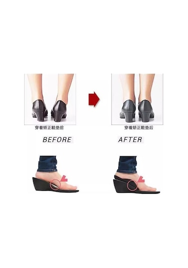 Esnek Düz Taban Düzeltici Topuk Yastığı