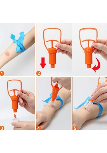 Ebitda Yılan Isırığı Kiti İçin Venom Çıkarıcı, Kamp Yardım Malzemeleri, Kırmızı Kırmızı