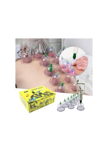 Samdoo 12 Bardaklı Profesyonel Vakum Şişe Seti - Kas Gevşetici, Kan Akışını Artırıcı Akupresür Masaj Aleti Çok Renkli