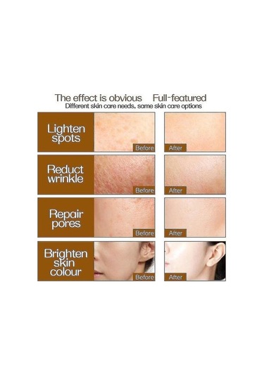 Zgts 192 Titanyum Mikro İğneli Dermaroller Cilt Bakımı 9566 Açık Mor