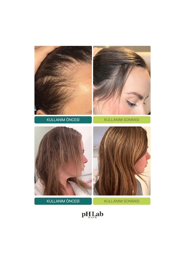 Phlab Hair Exosome Nad+ & Triple Pdrn Scalp Shot