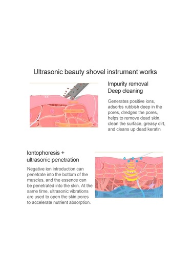 Sones Blk-d016 Ultrasonik Güzellik Küreği Cilt Makinesi Titreşim Ev Yüz Temizleme Ve Yıkama Masaj Aleti Güzellik Aleti Beyaz