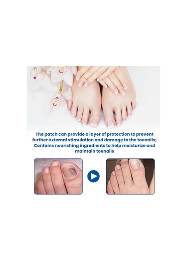 Singree 32 Adet Tırnak Mantar İyileştirici Yama - 2.8x2.3cm, Gliserin & Çay Ağacı Yağı İçeren Tırnak Onarım Yama Seti