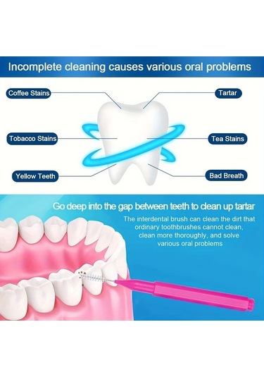 Willowhaven 100 Adet Diş Arası Fırçası - Siyah, Braces Ve Detaylı Diş Temizliği İçin