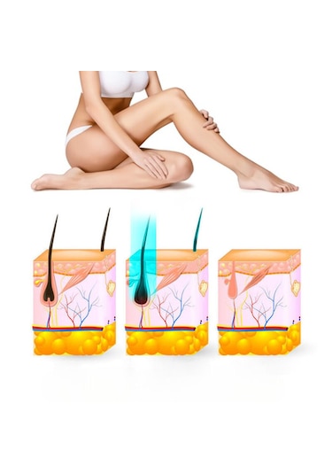Yui Iplv15 Pro 3 Başlıklı Buz Lazer Epilasyon Cihazı