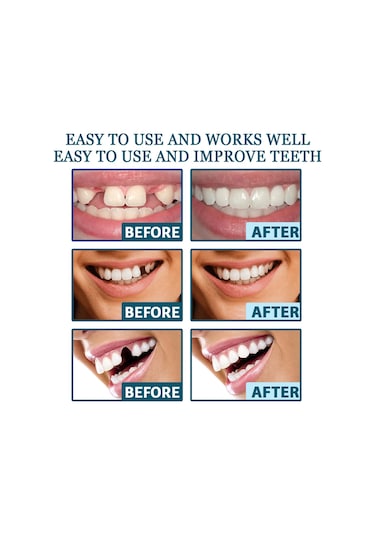 Mufunye Ayarlanabilir Takma Diş Seti: Doğal Görünümlü Ve Rahat Kullanım