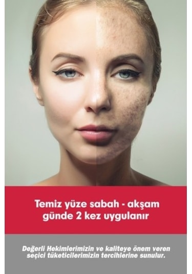 Tto Clinic Leke Kremi 75ml