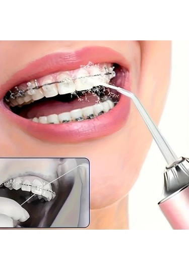 Willowhaven Yeşil Şarj Edilebilir Su Diş İpi 4 Jet Başlıklı Usb Şarj Taşınabilir Diş Temizleyici