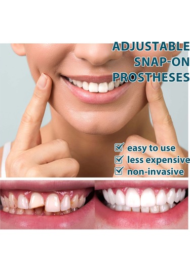 Mufunye Ayarlanabilir Takma Diş Seti: Doğal Görünümlü Ve Rahat Kullanım