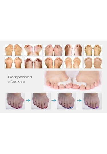 Ozclife Iki Parmaklı Makaralı Bunyon %100 Silikon - Türk Malı